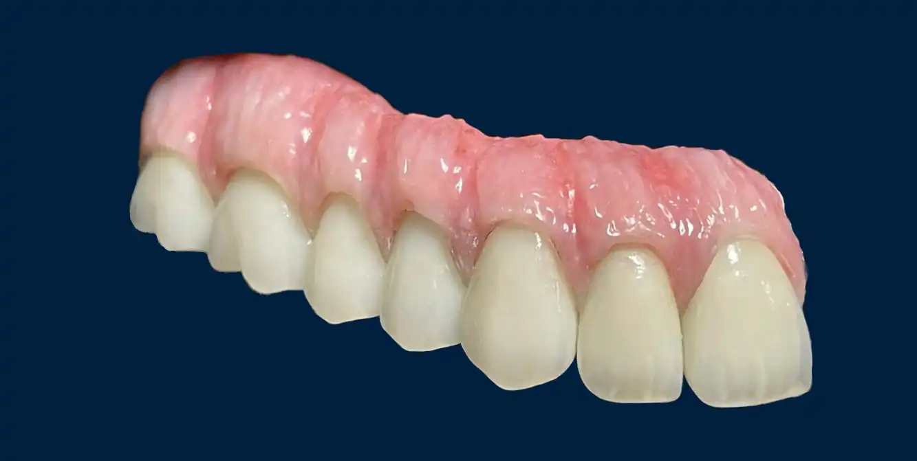 implantologie implantologie